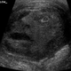Illustration for article titled A Frightened Face Appeared in the Ultrasound of a Man's Testicle